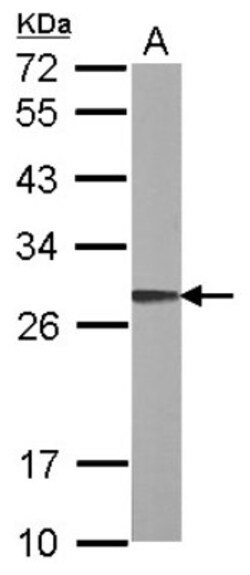 ARL1 Antibody, Novus Biologicals 0.1mL; Unlabeled:Antibodies, Polyclonal