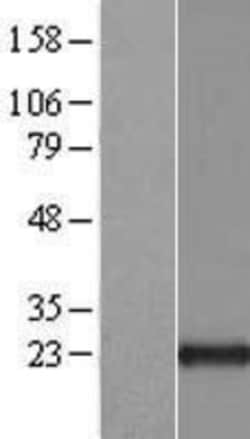 Novus Biologicals™ ARL1 Overexpression Lysate