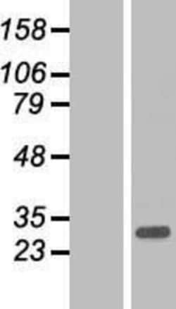 Novus Biologicals&trade;&nbsp;ARL10 Overexpression Lysate