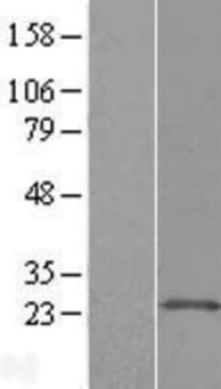 Novus Biologicals&trade;&nbsp;ARL11 Overexpression Lysate