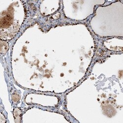 ARL11 Antibody, Novus Biologicals:Antibodies:Primary Antibodies