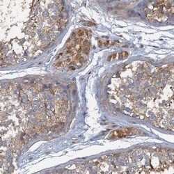 ARL11 Antibody, Novus Biologicals:Antibodies:Primary Antibodies
