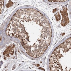 ARL13A Antibody, Novus Biologicals:Antibodies:Primary Antibodies