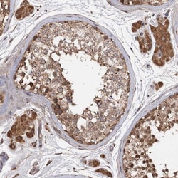 ARL13A Antibody, Novus Biologicals:Antibodies:Primary Antibodies