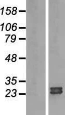 Novus Biologicals&trade;&nbsp;ARL15 Overexpression Lysate