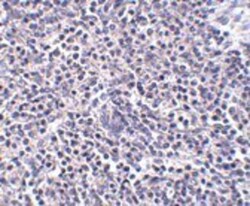 ARL15 Antibody - BSA Free, Novus Biologicals 0.025 mg, Unconjugated:Antibodies,
