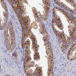 ARL16 Antibody, Novus Biologicals:Antibodies:Primary Antibodies