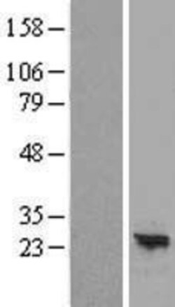 Novus Biologicals&trade;&nbsp;ARL16 Overexpression Lysate