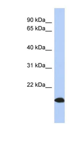 ARL17 Antibody, Novus Biologicals:Antibodies:Primary Antibodies