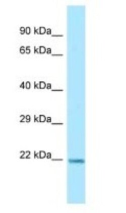 ARL1 Antibody, Novus Biologicals 20&mu;L; Unlabeled:Antibodies, Polyclonal