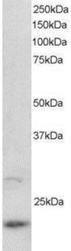ARL2 Antibody, Novus Biologicals 0.1mg; Unlabeled:Anticuerpos
