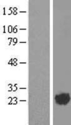 Novus Biologicals™ ARL2 Overexpression Lysate