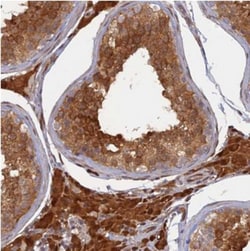 ARL2BP Antibody, Novus Biologicals 0.1mL; Unlabeled:Antibodies, Polyclonal