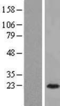 Novus Biologicals™ ARL3 Overexpression Lysate