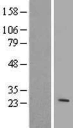 Novus Biologicals ARL4 Overexpression Lysate 0.1 mg | Buy Online | Novus Biologicals&trade; | Fisher Scientific
