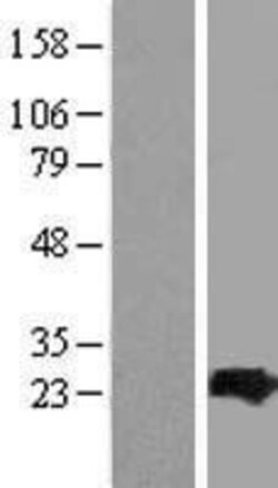 Novus Biologicals&trade;&nbsp;ARL4C Overexpression Lysate