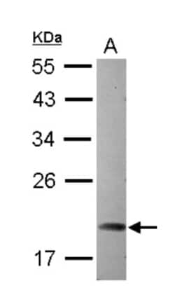 ARL5A Antibody, Novus Biologicals 0.1mL; Unlabeled:Antibodies, Polyclonal