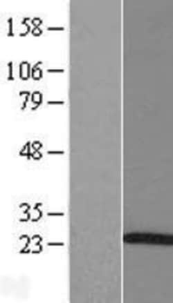 Novus Biologicals&trade;&nbsp;ARL5A Overexpression Lysate