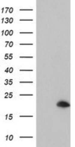 ARL5B Antibody (OTI2D7), Novus Biologicals 0.1 mL | Buy Online | Novus Biologicals | Fisher Scientific