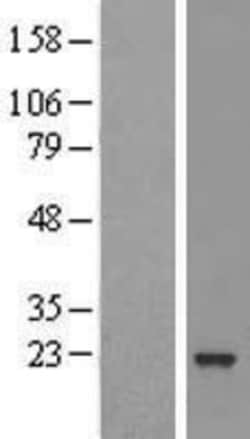 Novus Biologicals™ ARL5B Overexpression Lysate