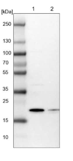 ARL8A Antibody, Novus Biologicals 0.1mL; Unlabeled:Antibodies, Polyclonal