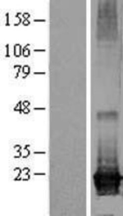 Novus Biologicals&trade;&nbsp;ARL8A Overexpression Lysate