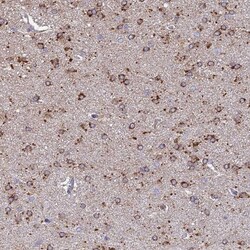 ARL8A Antibody, Novus Biologicals 0.1mL; Unlabeled:Antibodies, Polyclonal