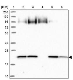 ARL8A Antibody, Novus Biologicals 0.1mL; Unlabeled:Antibodies, Polyclonal