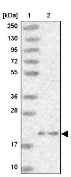 ARL8A Antibody, Novus Biologicals 0.1 mL | Buy Online | Novus Biologicals | Fisher Scientific