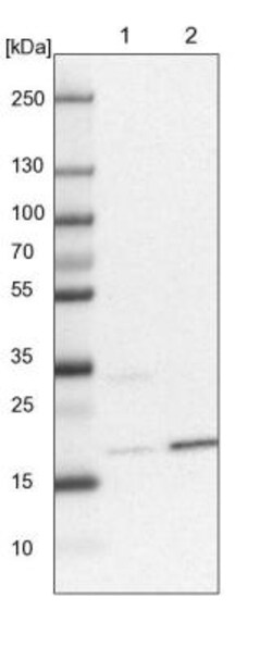 ARL8A Antibody, Novus Biologicals 0.1 mL | Buy Online | Novus Biologicals | Fisher Scientific