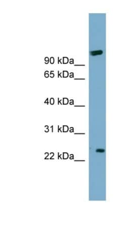 ARL8B Antibody, Novus Biologicals 100&mu;L; Unlabeled:Antibodies, Polyclonal