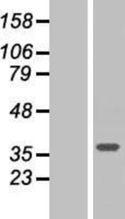 Novus Biologicals&trade;&nbsp;ARMC10 Overexpression Lysate