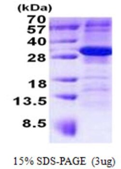 Novus Biologicals&trade;&nbsp;Recombinant Human ARMC10 His Protein