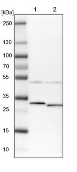 ARMC10 Antibody, Novus Biologicals:Antibodies:Primary Antibodies