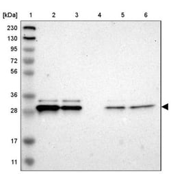 ARMC10 Antibody, Novus Biologicals:Antibodies:Primary Antibodies