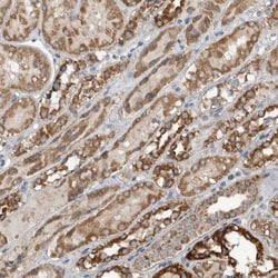 ARMC1 Antibody, Novus Biologicals 0.1mL; Unlabeled:Antibodies, Polyclonal