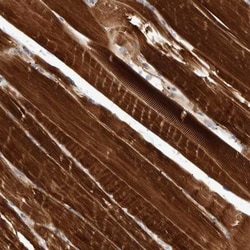 ARMC2 Antibody, Novus Biologicals 0.1 mL | Buy Online | Novus Biologicals | Fisher Scientific