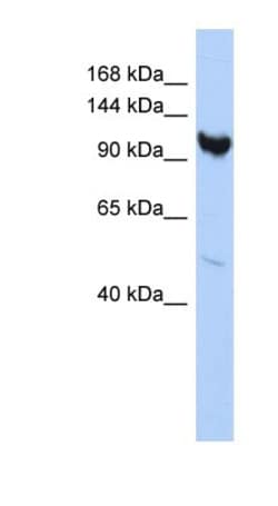 ARMC3 Antibody, Novus Biologicals 100μL; Unlabeled:Antibodies, Polyclonal