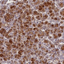 ARMC6 Antibody, Novus Biologicals 0.1mL; Unlabeled:Antibodies, Polyclonal