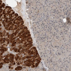 ARMC7 Antibody, Novus Biologicals:Antibodies:Primary Antibodies