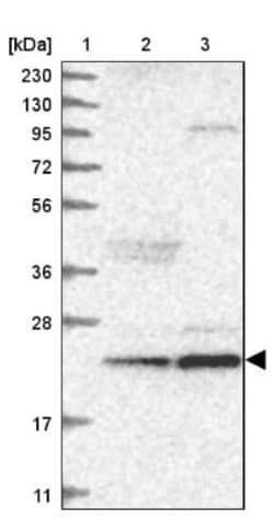 ARMC7 Antibody, Novus Biologicals:Antibodies:Primary Antibodies