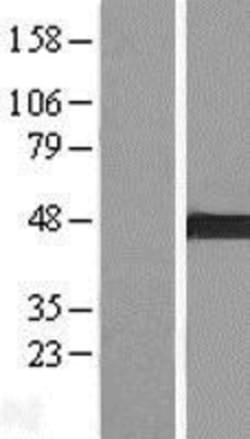 Novus Biologicals&trade;&nbsp;ARMC8 Overexpression Lysate