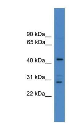 ARMC8 Antibody, Novus Biologicals:Antibodies:Primary Antibodies
