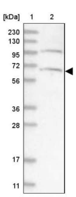 ARMC8 Antibody, Novus Biologicals 25ul | Buy Online | Novus Biologicals | Fisher Scientific