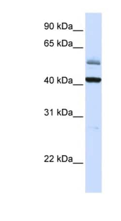 ARMCX1 Antibody, Novus Biologicals 100&mu;L; Unlabeled:Antibodies, Polyclonal