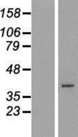 Novus Biologicals&trade;&nbsp;ARMCX5 Overexpression Lysate