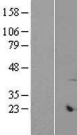 Novus Biologicals&trade;&nbsp;ARMCX6 Overexpression Lysate