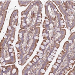 ARMCX6 Antibody, Novus Biologicals 0.1mL; Unlabeled:Antibodies, Polyclonal