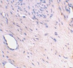 ARMER Antibody, Novus Biologicals 0.1mg; Unlabeled:Antibodies