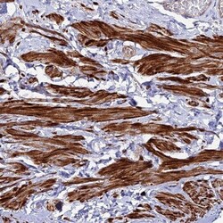 ARMER Antibody, Novus Biologicals 0.1mL; Unlabeled:Antibodies